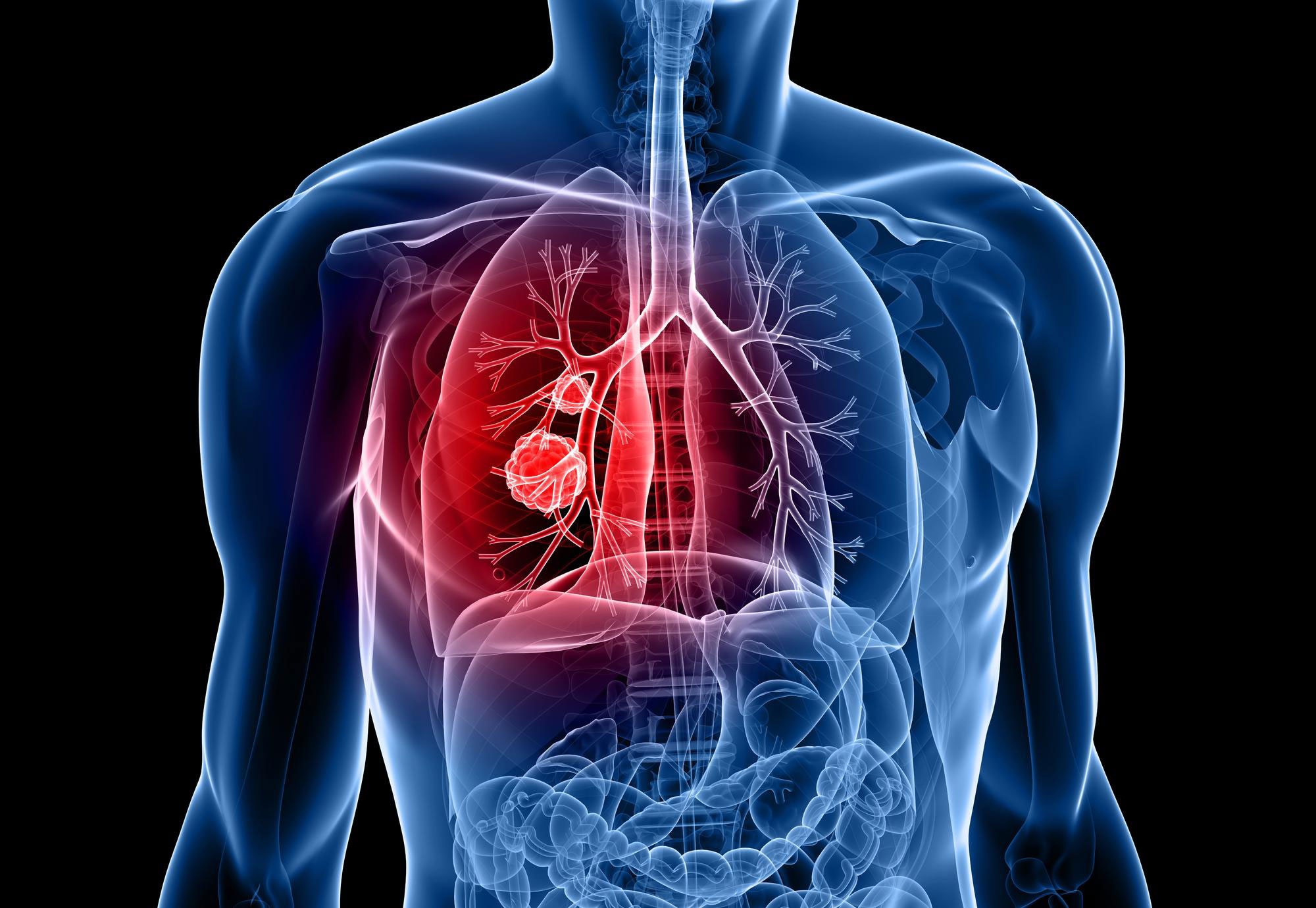 Effect of COVID-19 on Lungs