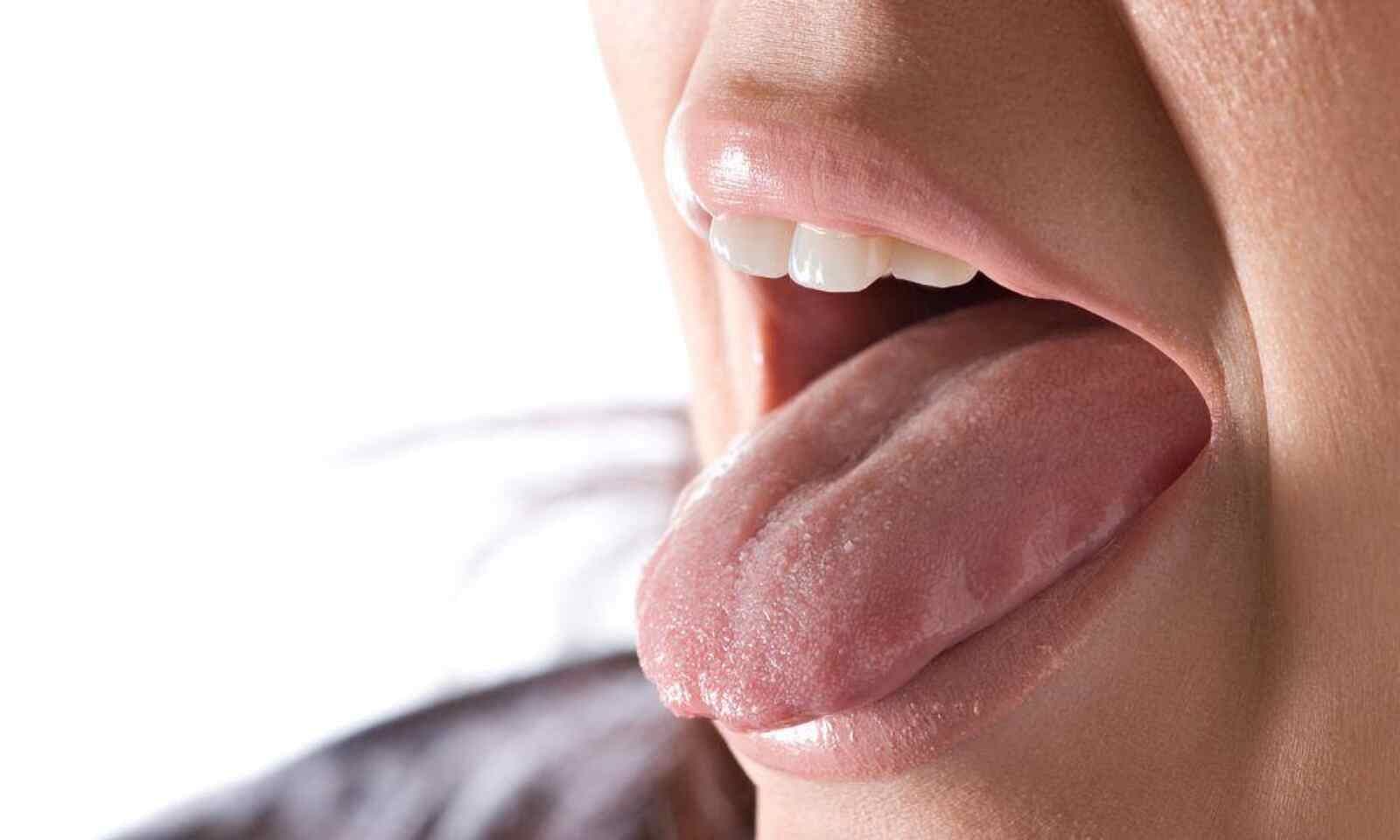 Metallic Taste In Mouth Post Covid 19 Causes And Treatments