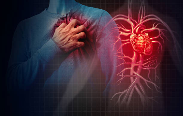 Post-Covid Cardiovascular Diseases
