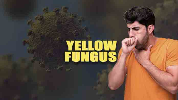 What is Yellow Fungus? How You Could Stay Safe Right Now?